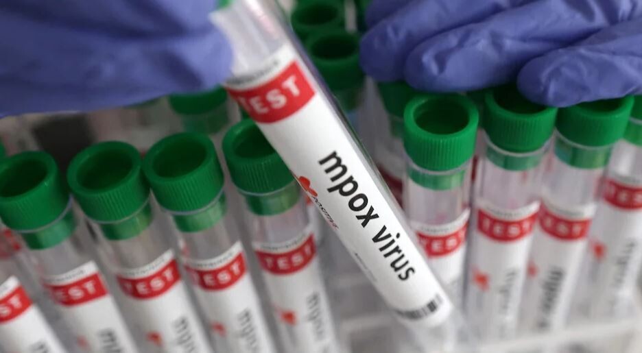 Нигерия получила 10 000 доз вакцины от обезьяньей оспы