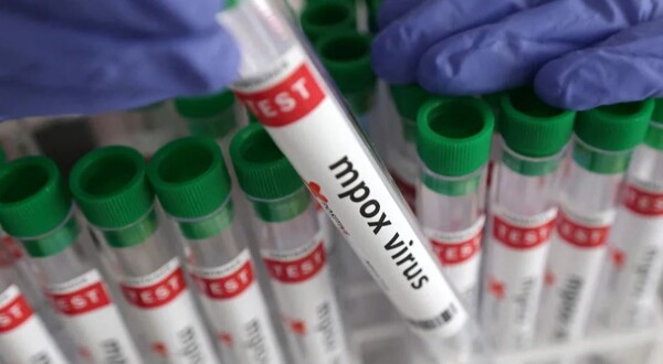 Нигерия получила 10 000 доз вакцины от обезьяньей оспы